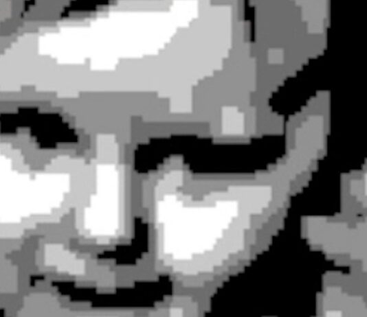 Зір відновлено за допомогою протезу сітківки