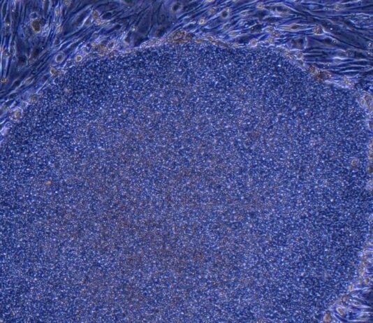 Глобальні Технологічні та Медичні Оновлення: Від Цензури ІІ до Перепрограмованих Кліток